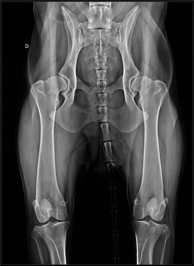 Radiografia
